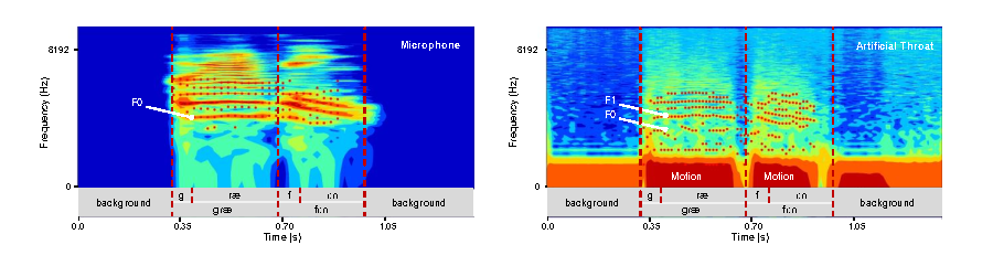 20230224-人工喉新闻稿-任天令课题组-图3 人工喉器件与麦克风采集的语音信息标注和共振峰特征分析.png