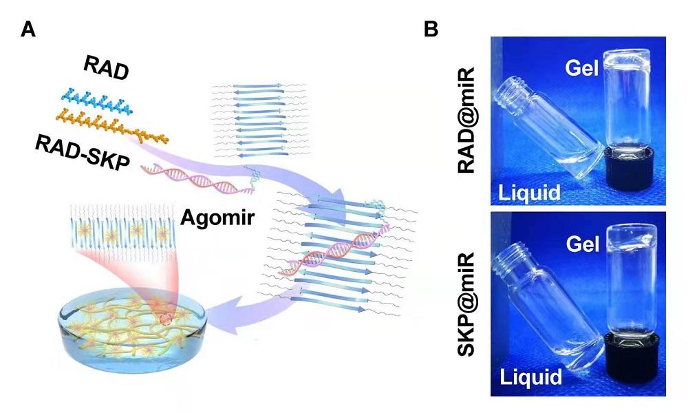 材料学院王秀梅团队合作通过水凝胶递送抑制骨关节衰老miRNA促进软骨再生